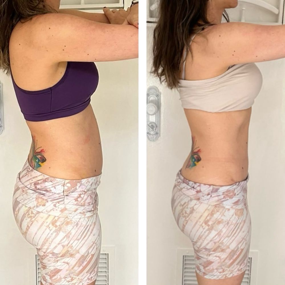 Antes e depois - resultado Afinatto