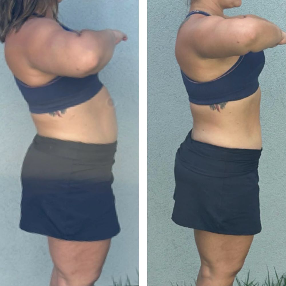Antes e depois - resultado Afinatto