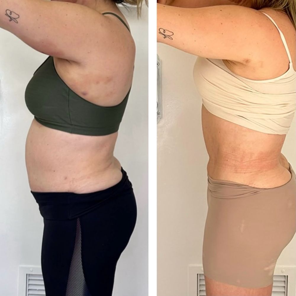 Antes e depois - resultado Afinatto